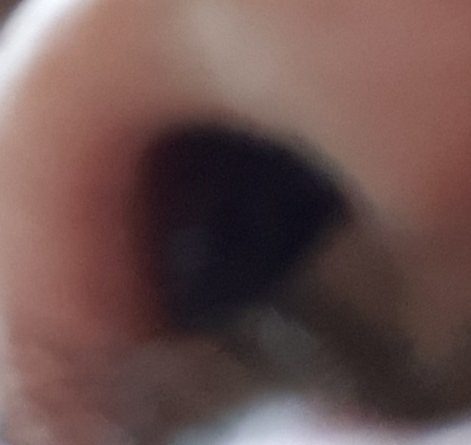 This is the nostril that got the Covid swab